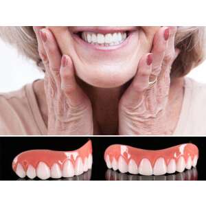 Azonnali Mosoly - Ideiglenes Felső Fogsor