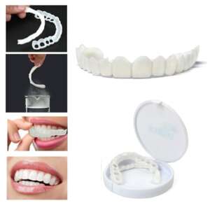 Smile idiglenes foghíd, fogsín