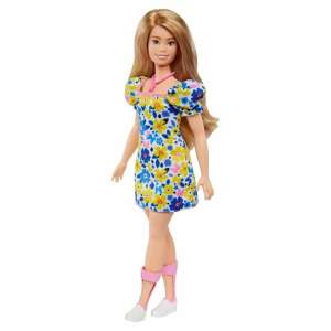 Barbie Fashionista barátok - Down-szindrómás baba 87184220 