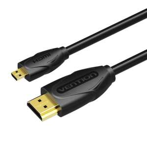 Vention HDMI - Micro HDMI kábel 1,5m fekete (VAA-D03-B150) (VAA-D03-B150) 87296736 