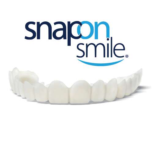 Snap-On-Smile ideiglenes felső Foghíd