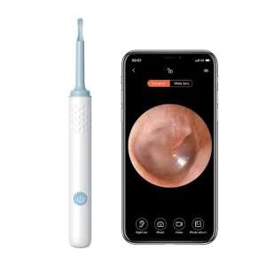 Intelligentes Endoskop zum Reinigen der Ohren, 5 MP 100-Pixel-Kamera, Full HD und LED-Licht X 6, WLAN, inklusive Zubehör, Ladeset, Akku 240 mAh, wasserdicht IP67, weiß 95863757 - Test-Analysegerät