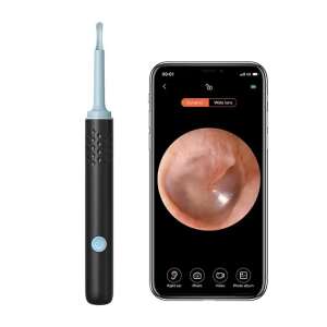 Cameră wireless pentru curățarea urechilor cu ecranul telefonului care arată canalul urechii, cameră pentru curățarea urechilor Jiuxi - Endoscop
