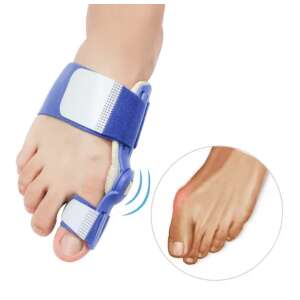 Ortopédiai sín, korrekciós rögzítés nőknek és férfiaknak, nagylábujj, Hallux valgus fájdalomcsillapítás műtét nélkül, korrekció/áthelyezés, nappali és éjszakai tartás. Kék