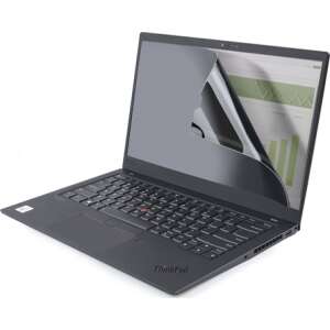 StarTech.com 15,6 hüvelykes laptop betekintésvédő szűrő, keret nélküli betekintésvédő fólia, vakítómentes, karcálló, megvédi a képernyőt a kíváncsi szemektől - Képernyővédő fólia
