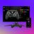 Turtle Beach Stealth Pivot, Xbox Series X|S, PC, mobil, Smart TV, RGB, efect Hall, controler fără fir 140715760