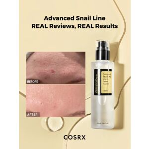 Hidratáló szérum koncentrált csigakivonattal COSRX Advanced Snail 96 Mucin Power Essence, 100ml 140774479 - Bőrápolás