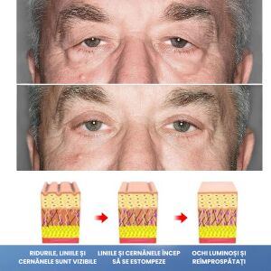 4 x Ser Contur Ochi cu Peptide, Tratament Anti-Rid, Anti-Cearcane, Lifting, Hidratare Intensa, Fermitate, Reducere Umflaturi, Luminozitate, Efect Revigorant, Ingrijire Anticearcan, Gel Ochi Hipoalergenic, JP Gel Ochi 15ml, Alb Transparent