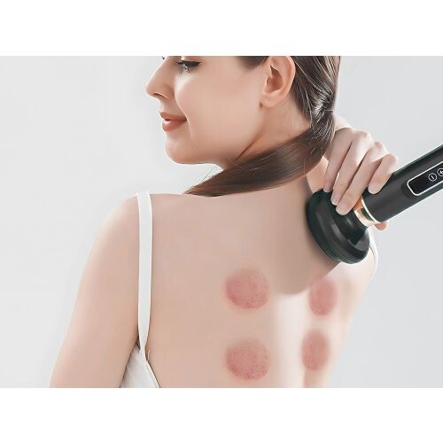 Akkumulátoros köpölyöző masszírozó - fekete 146749942