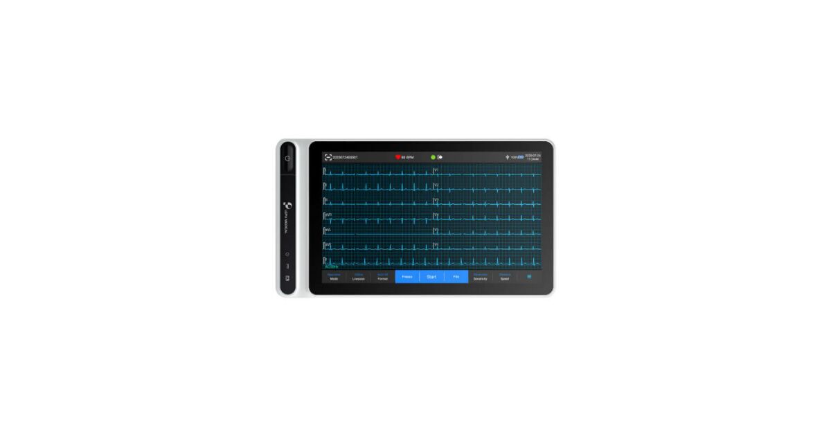 Lepu Neo ECG S120 – Hordozható, professzionális EKG tabletes készülék ...