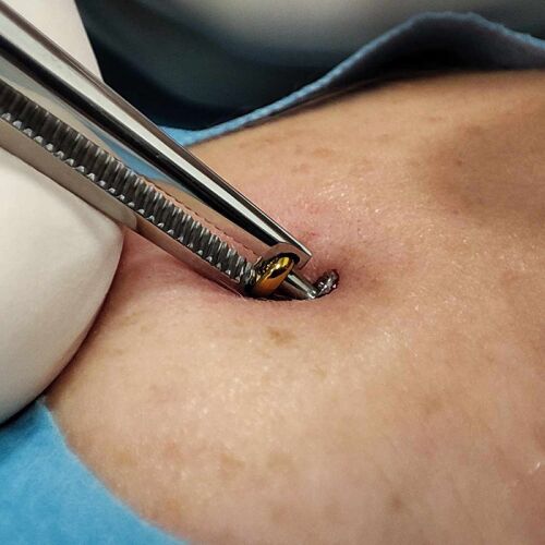 Mikrodermális piercing csipesz NK-013 használat közben, testékszerészeti eszköz - Piercing fogó