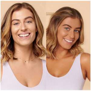 Vorher-Nachher-Vergleich mit ST. MORIZ Fast Tan Lotion, der einen natürlich aussehenden Teint auf dem Gesicht und Hals einer Frau zeigt. - Bräunungscreme und -öl