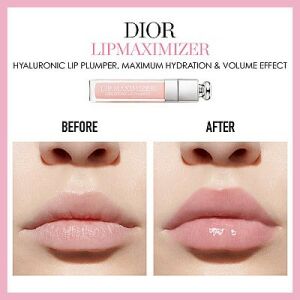 Dior Lip Maximizer Vorher-Nachher-Ergebnisse - Lippen