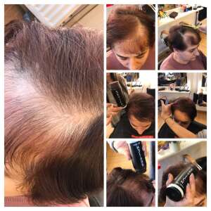 Sevich Hair Building Fibers, for Thinning Hair, Hair Loss, Alopecia, Dark Satin, 25g