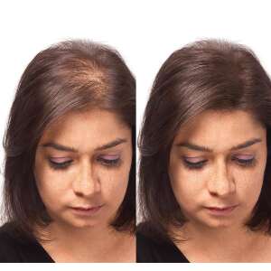 Sevich Hair Building Fibers, for Thinning Hair, Hair Loss, Alopecia, Reddish, 25g