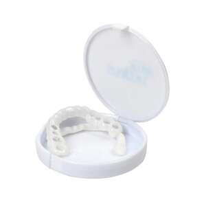 Kozmetikai foghíd, ideiglenes fogsortakaró – élvezd a mosoly örömét!